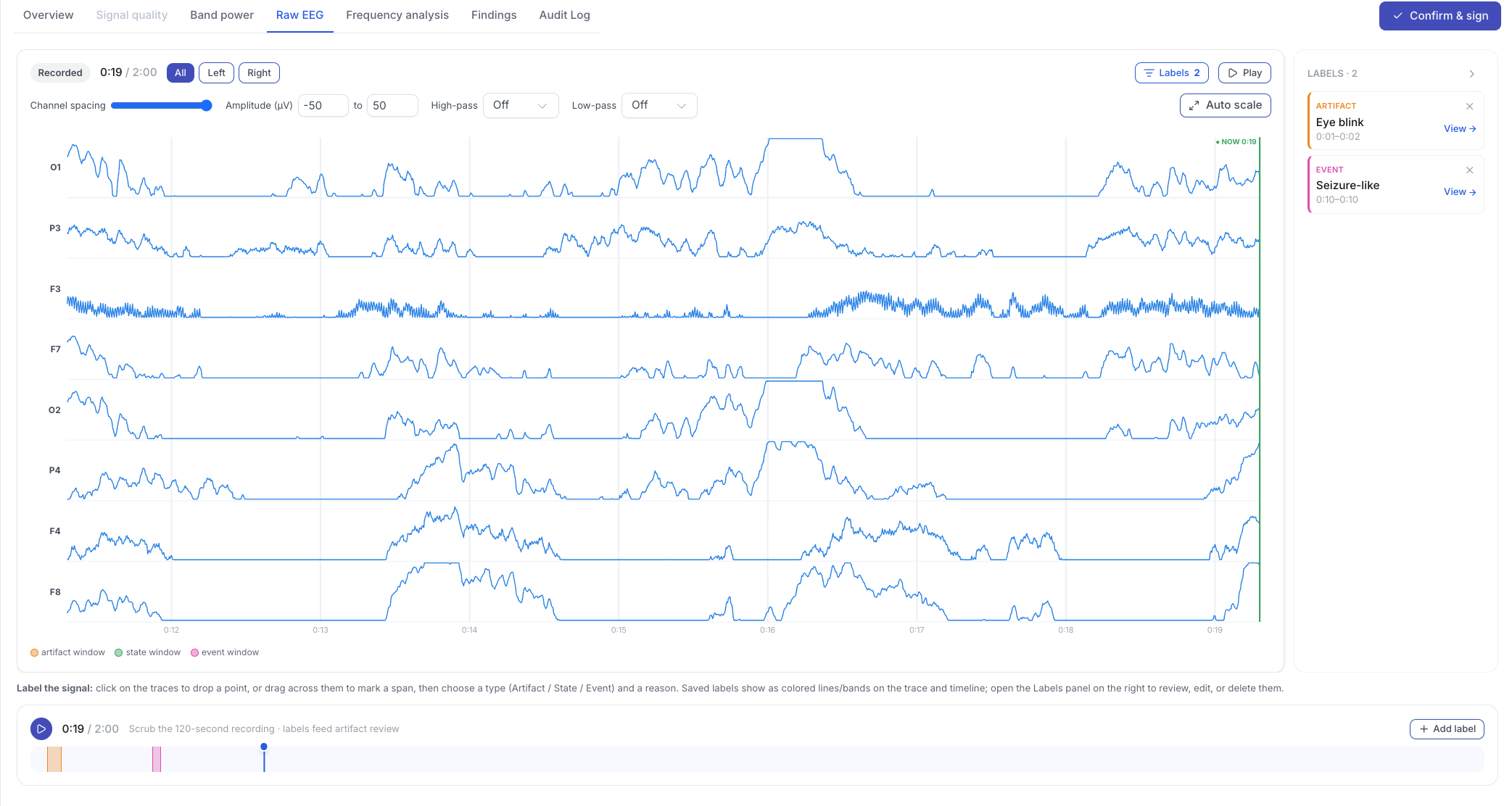 SignalNED raw EEG: source waveforms available for clinical inspection and event labeling.